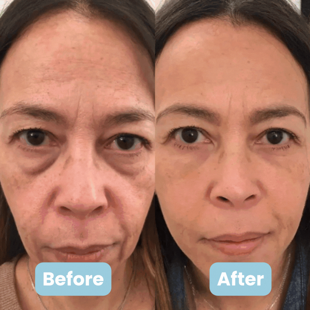 3-in-1 LED Facial Sculptor + 4 FREE Gifts