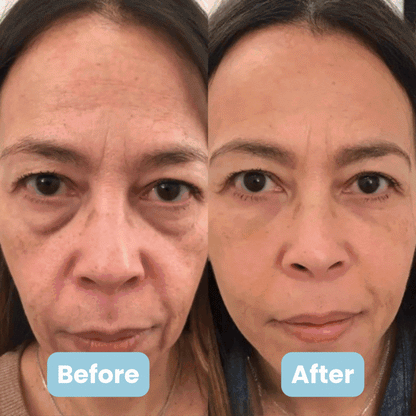 3-in-1 LED Facial Sculptor + 4 FREE Gifts